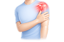 Frozen Shoulder