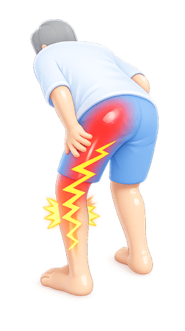 Sciatica